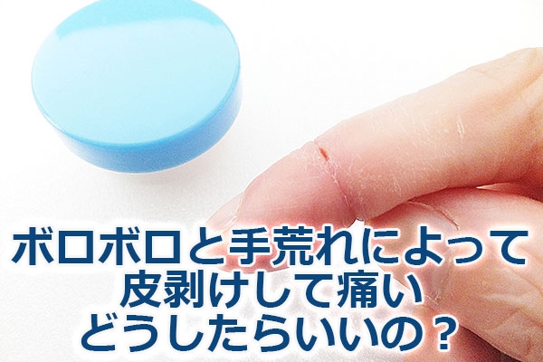 ボロボロと手荒れによって皮剥けして痛い・どうしたらいいの？